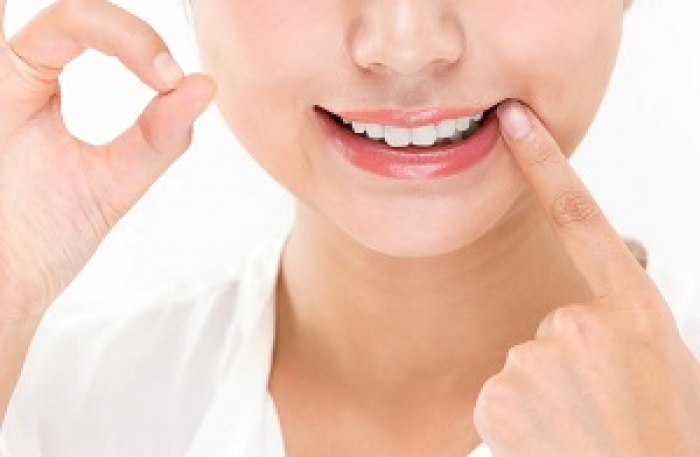 広島県広島市中区薬研堀のヘルス オアシス求人　最新トピック　歯列矯正をしながら働くことはできますか？画像